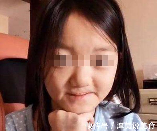 孕妇|医生三类孕妇容易生“兔唇”宝宝,如果你在其中,就要小心了