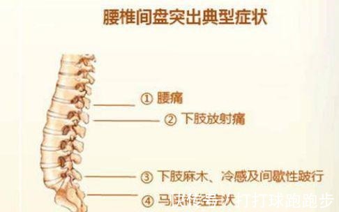 腰椎|腰椎间盘突出怎么办大黄+生姜可针对，用了都说好！