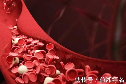 血管健康|颈动脉斑块怎么防治？呵护血管健康，3个健康常识，一个也不能少