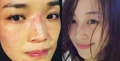 长期素颜和每天化妆的女人，坚持10年后，皮肤差异巨大