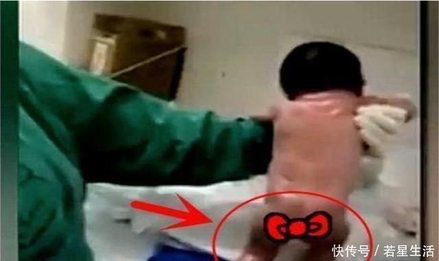 新生儿|“最牛新生儿”走红,脐带还没剪就想“跑”,还好医生眼疾手快