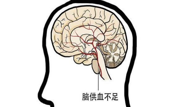 脑供血不足时，人的身体会很“诚实”，别总对