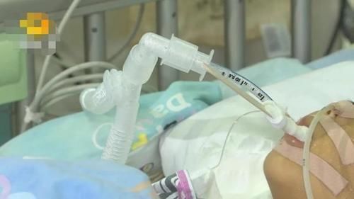 蘑菇|一家四口吃完饭,2岁弟弟和3岁哥哥相继身亡,医生说出原因太揪心