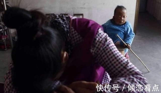 智力障碍|身体像3岁大婴儿却已活了30年,从未叫过一声妈,真相让人落泪