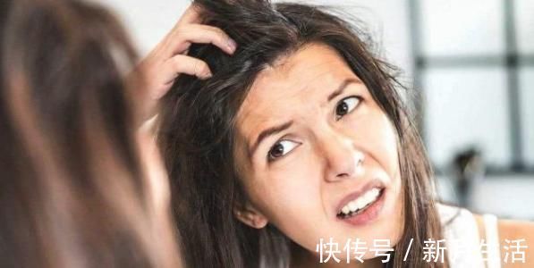 头皮|头皮里抓出“白泥”是头皮屑吗?八成是暗示3种问题,别忽视了