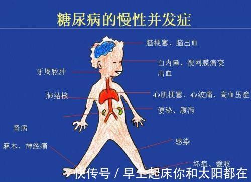 蕹菜|糖尿病人的福音常吃“此菜”,堪比打胰岛素,血糖乖乖降下来!