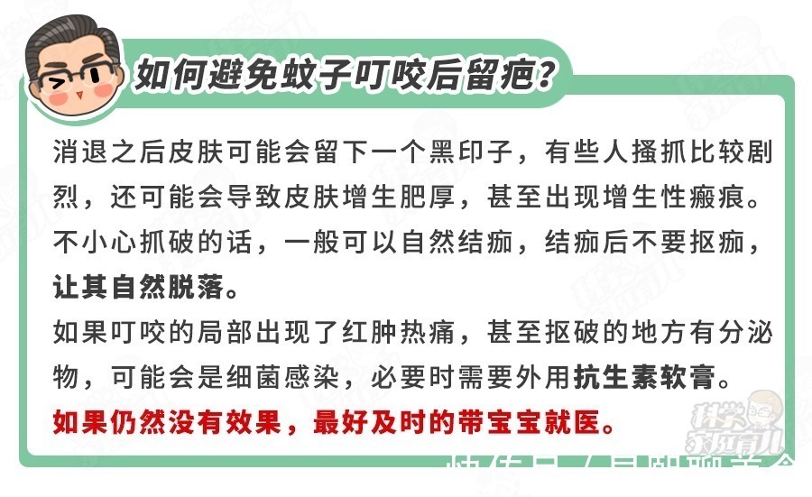 胆红素|痒、肿、挠破还留疤!娃被蚊子亲吻后,3招止痒、消肿!