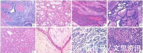 |沙雕动画，搞笑：校园最美的食堂，结果太闹心了