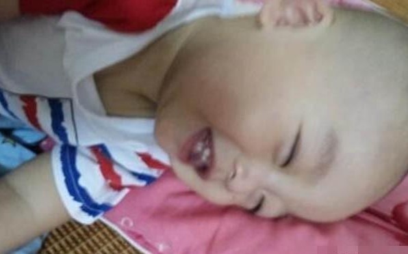 睫毛|宝宝1岁还不会说话,爷爷怀疑没剪舌根,医生回去吧治不了