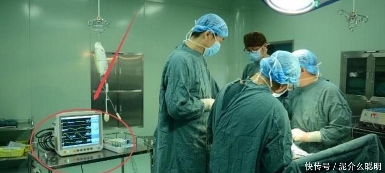 全身麻醉时,医生是怎么判断患者睡着了吗?资深麻醉医生揭晓