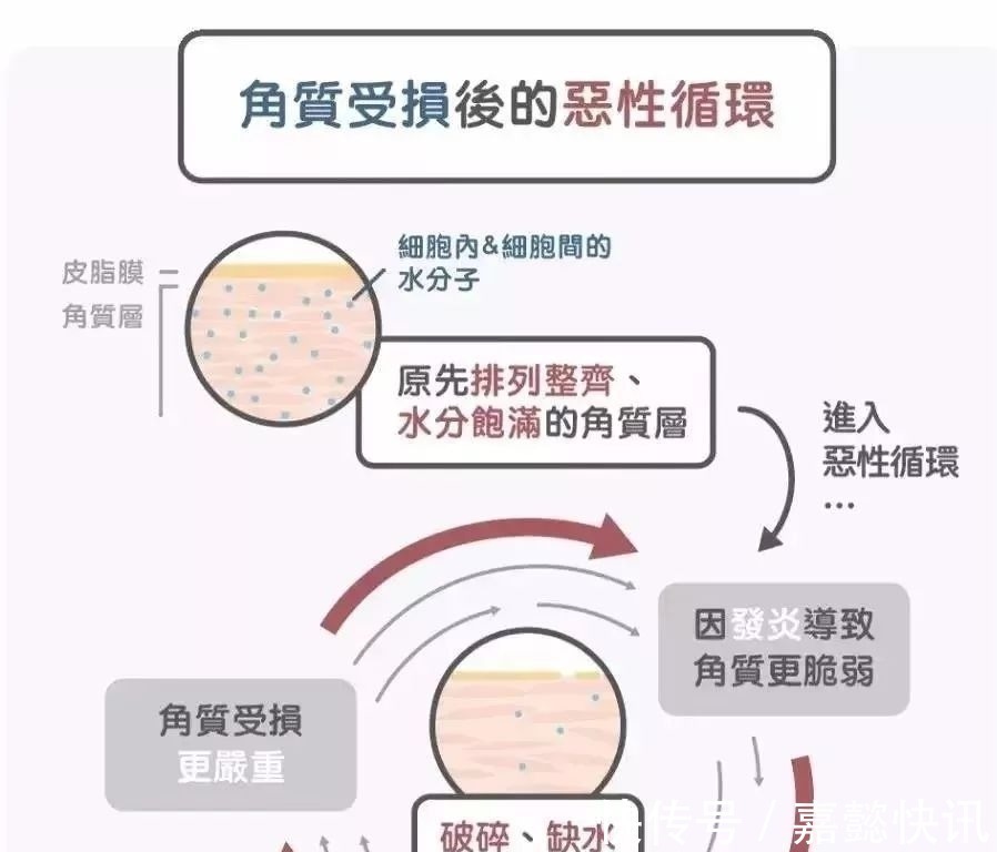 化学型 小心！以下5个护肤坏习惯，能让你的毛孔越来越大……