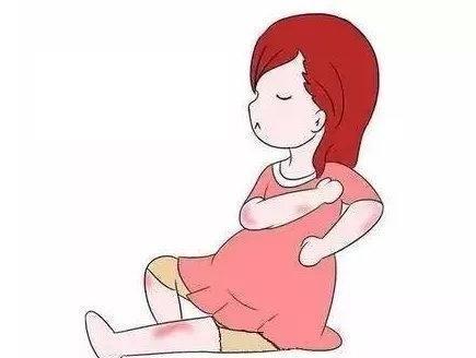 生理性水肿|10个孕妈9个肿，孕期水肿做好这几点，让你告别“大猪蹄子”！