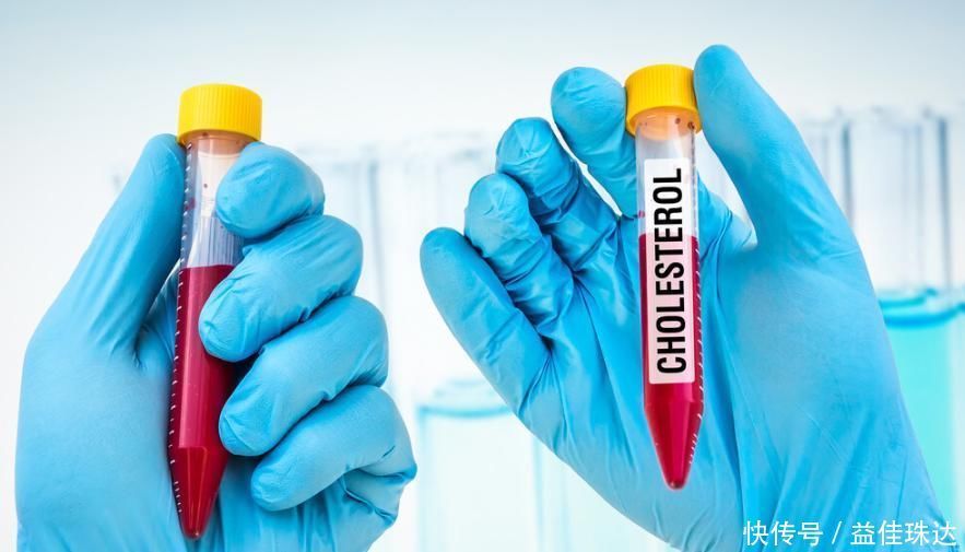 甘油三酯过高怎么办坚持5件小事,清理血管垃圾、甘油三酯降了