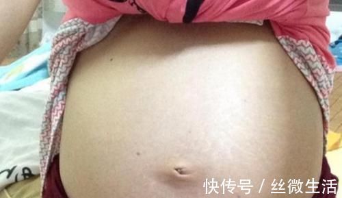奥秘|怀孕后“肚脐凹”不易长妊娠纹,是真的吗?背后奥秘很多人不知道