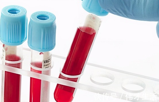 专家|糖尿病疫苗来了,所有患者都能打么看看专家怎么说