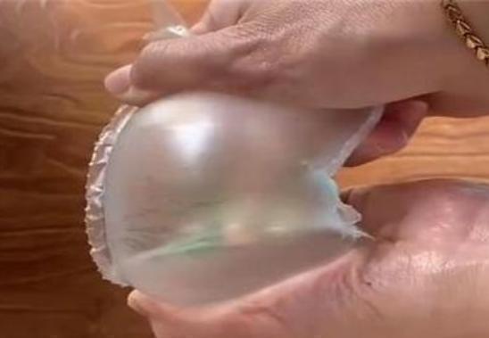 宝妈|妊娠纹是如何形成的丈夫们都该来看看,母亲的苦难应该被理解