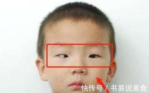 对手机|5岁男童长期玩手机,黑眼珠逐渐“消失”,医生很难恢复