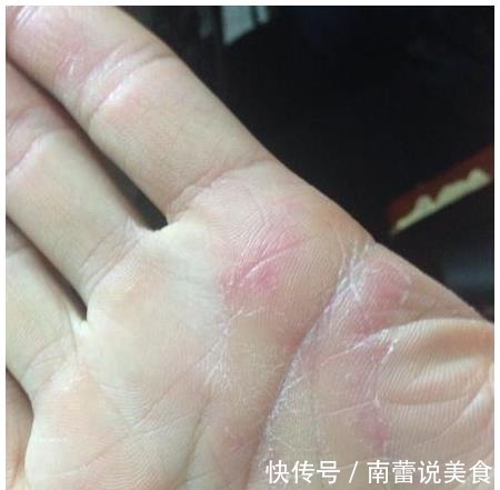 胃部|养胃冠军公布了,不是小米,平时可劲吃,胃干净更强壮!