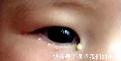 绞痛|宝宝身上的6个“奇怪现象”, 家长有被吓到过吗!