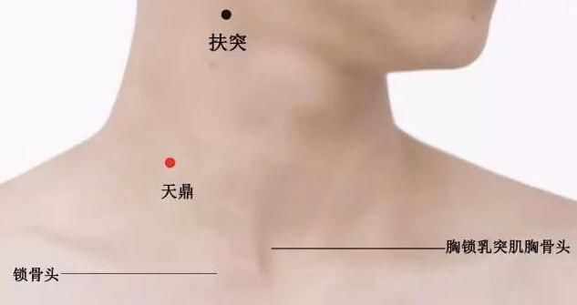 有甲状腺结节的朋友看过来!常按这个妙穴,葡萄大结节完全消失了