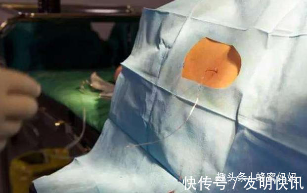 产妇|不打麻药“生剖”的剖腹产真实存在吗母爱的伟大,并非纸上谈兵