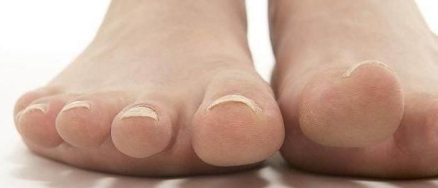 就很有可能是由于|“肾”好不好看脚,如果脚上没有3个表现,说明你的肾还很健康