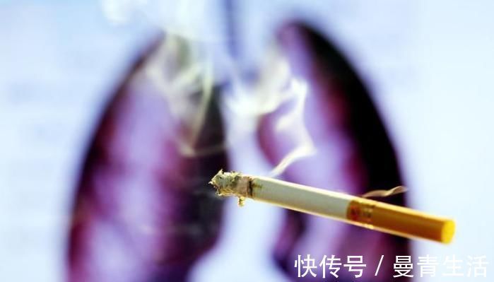 研究小组|肺癌存活率仅15专家补镁降17%肺癌风险,牢记3招是预防关键