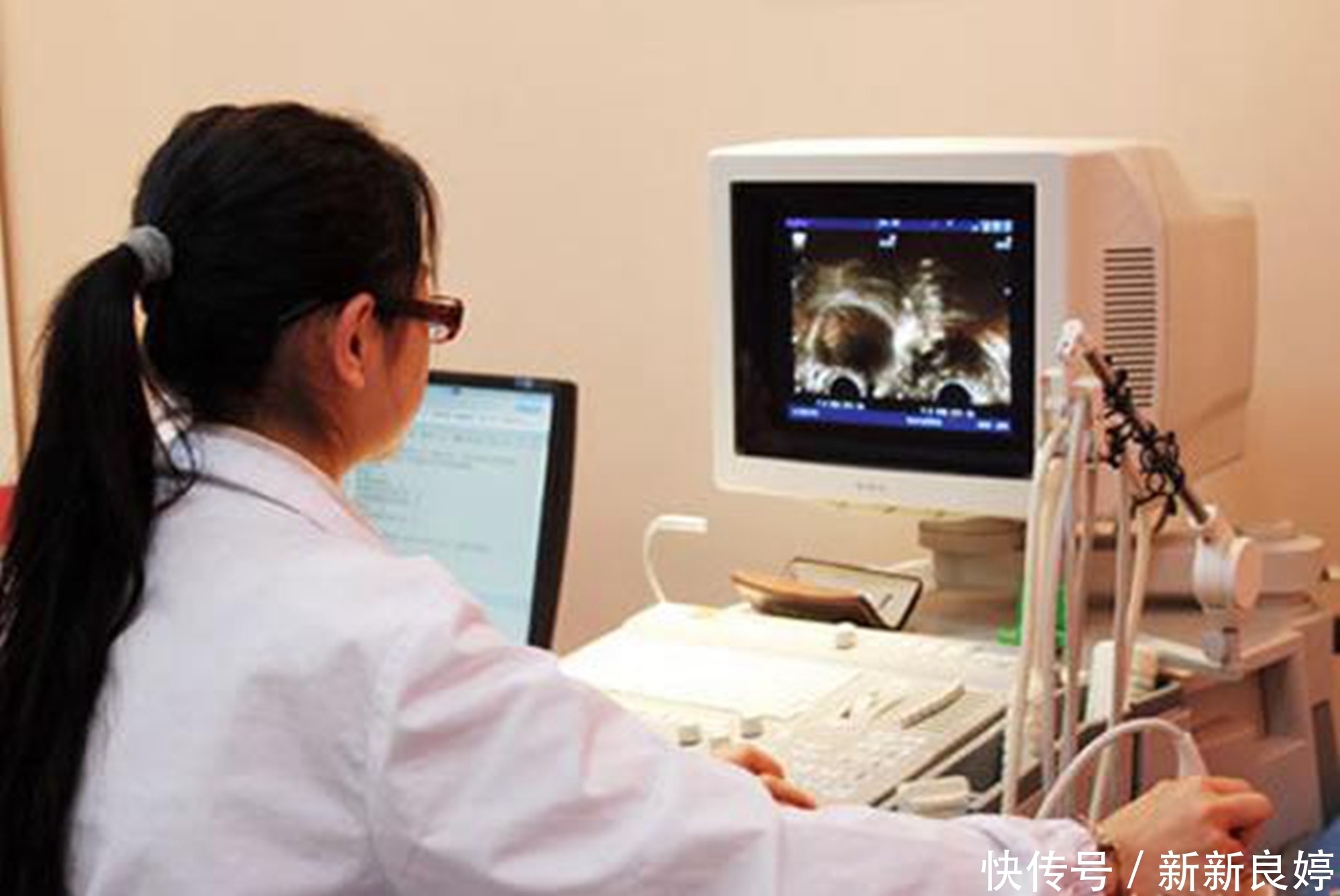 指标|孕期B超单上四个指标,暗示胎儿健康信号,达标孕妈可以放心了