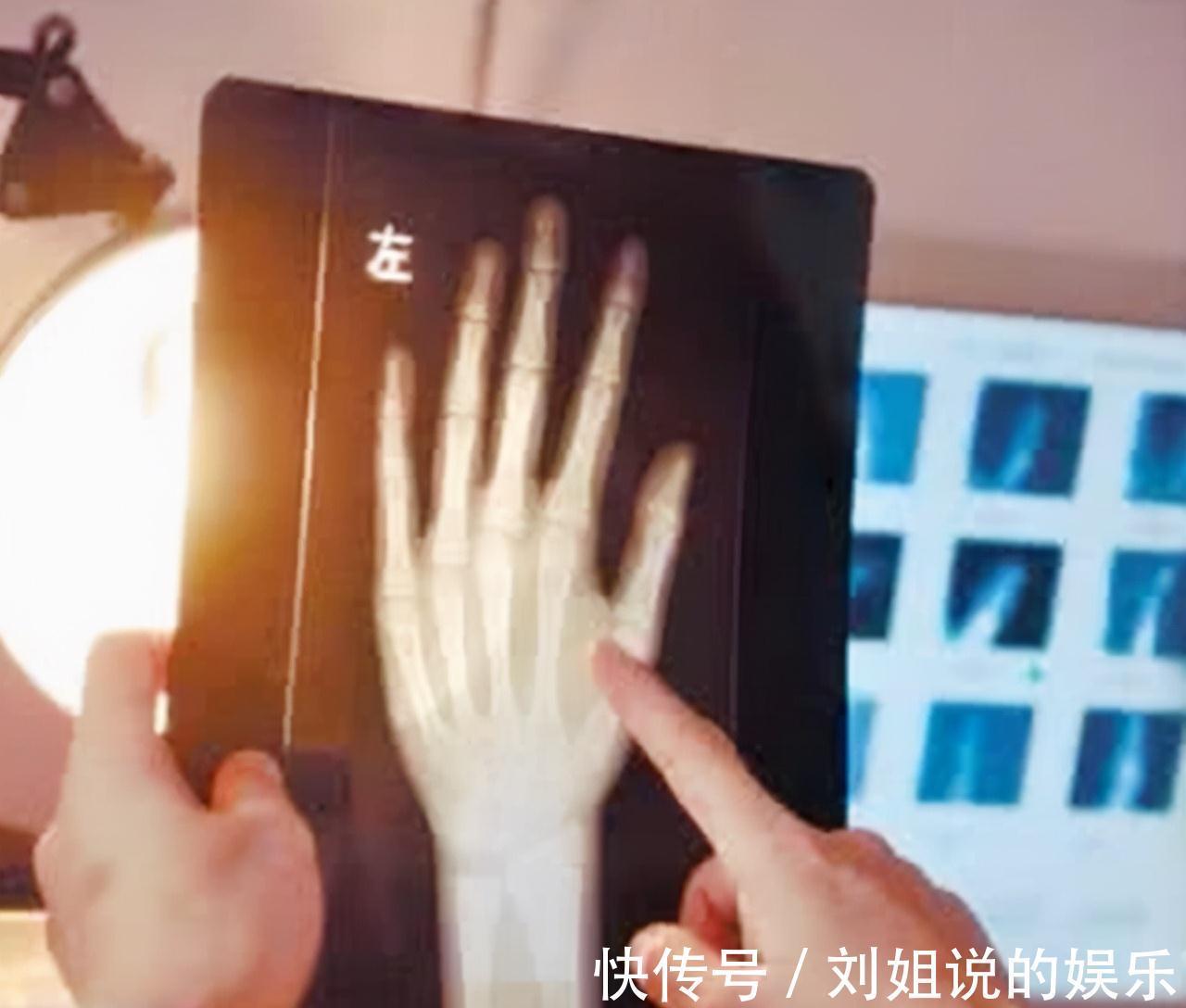 遗传|孩子是“早长”还是“晚长”,用公式能计算出来,家长可自行对照