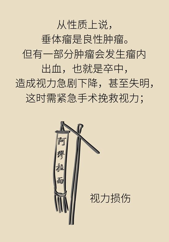 内分泌失调|变丑、变胖、内分泌失调……这些糟心事警惕脑肿瘤