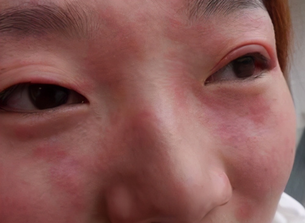 皮肤|换季时,如何护肤才安全有效?