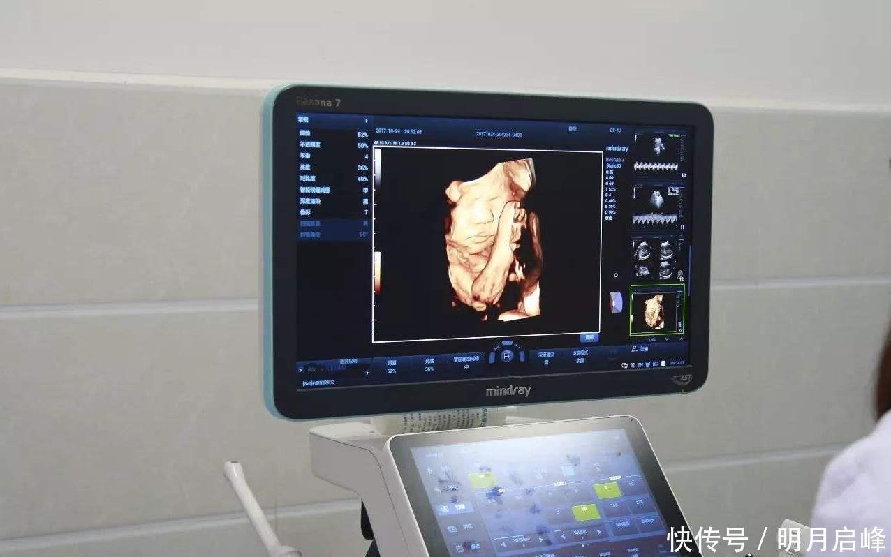 性别|怀“小王子”的宝妈,身上有这4大特征,赶快接好孕吧