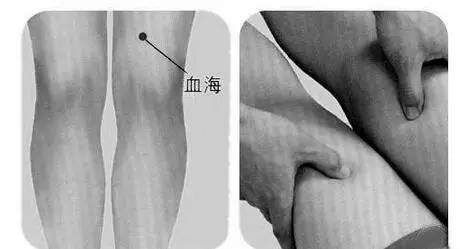 徽琼散|少见的祛湿方子，轻松祛除湿气，快分享给家人吧！