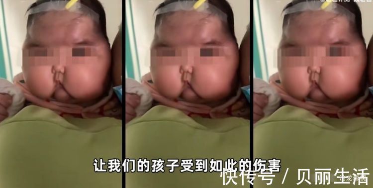沧龙|“大头娃娃”卷土重来?5个月孩子用母婴产品变成大头娃娃!