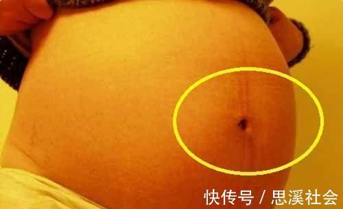 肚子|孕妈肚脐凸比凹好?别自己吓自己,区别倒是有,真相孕妈要了解