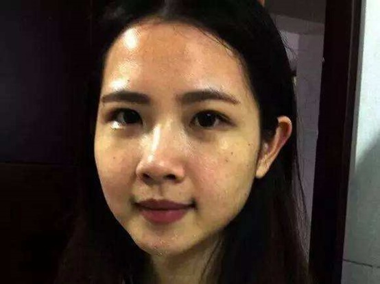 脂肪肝|拜拜了，肝炎，拜拜了，脂肪肝，拜拜了，肝硬化