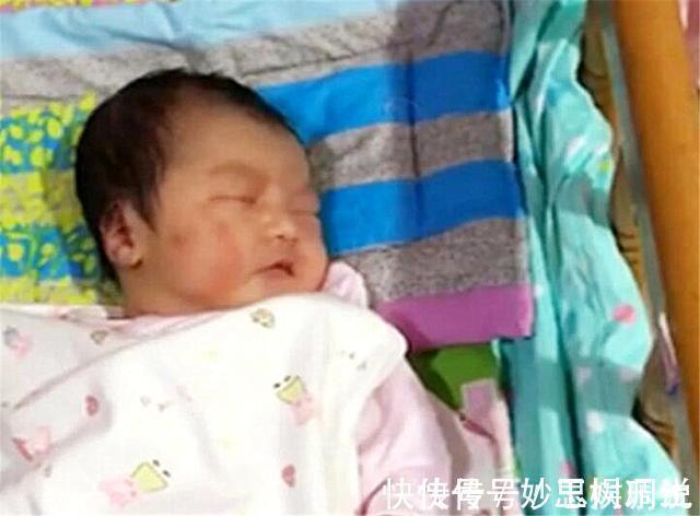 产钳|宝宝出生3个月,脸上“产钳印”明显,儿媳遭婆婆责备“没本事”
