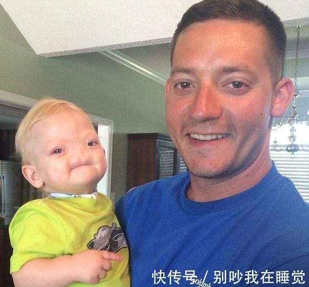 男婴|2岁男婴竟无鼻生活两年,随后发生的事让人落泪
