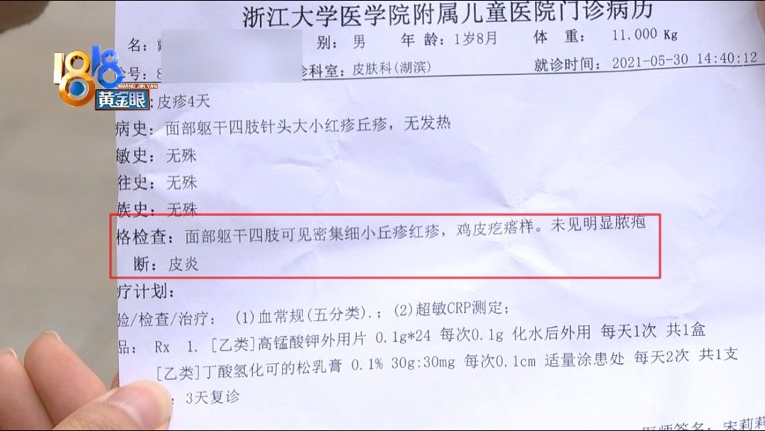 王女士|孩子身上爆发红疹，母亲怀疑泳池水质