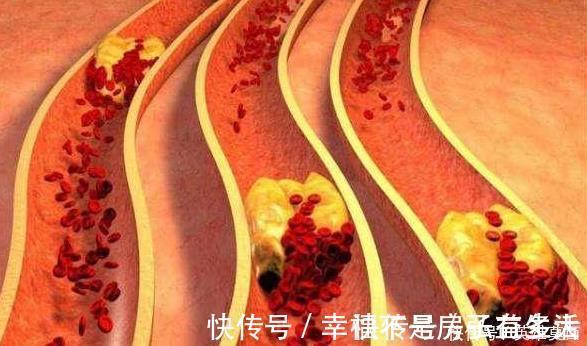 鱼肉|爱吃鱼的朋友脑袋聪明,可营养师建议以下的3种鱼尽量远离不吃