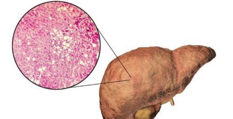 特点|“短命”的人,大多有5个特点,若一个不占,恭喜有望长命百岁