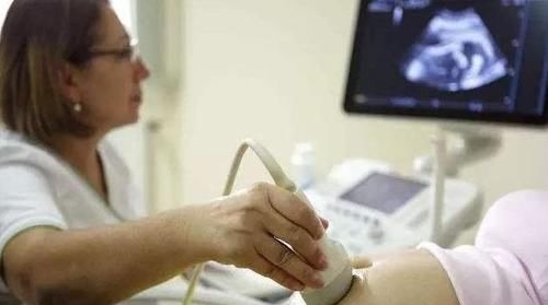 孕妇|为什么产检时，医生会问“头胎还是二胎”？这几点不同你该了解