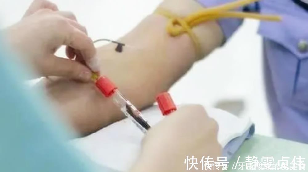 血管|一个孕期下来,孕妇要抽多少管“血”?过来人:血管都“干瘪”了