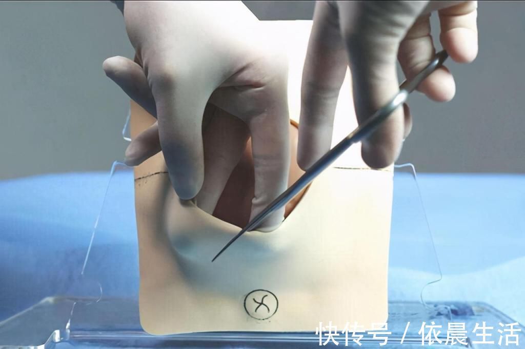 顺产|顺产和剖腹产,哪个更受罪过来人一个先苦后甜,一个先甜后苦