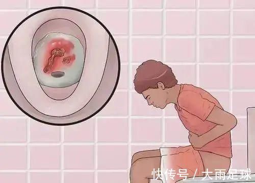 便血|痔疮肉球怎么消除,做到两点,21天对痔疮肉球说拜拜!