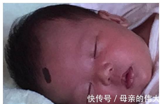 赵女士|胎记：最喜欢3种孕妇，孕期常做这些事，难看的胎记就会找上宝宝