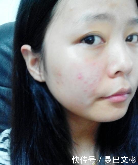 角质层|为何建议女生别“天天敷面膜”,这3个原因你得知道,不敢敷了