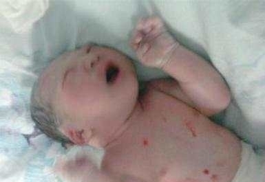 怀孕|女子怀孕肚子超大个个都以为双胞胎, 生的时候把接生的医生吓坏!