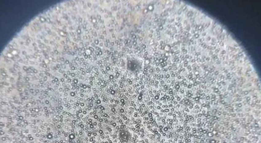 卵巢癌|当母乳被放大1000倍后,在显微镜下轻轻蠕动,纯净得令人难以置信