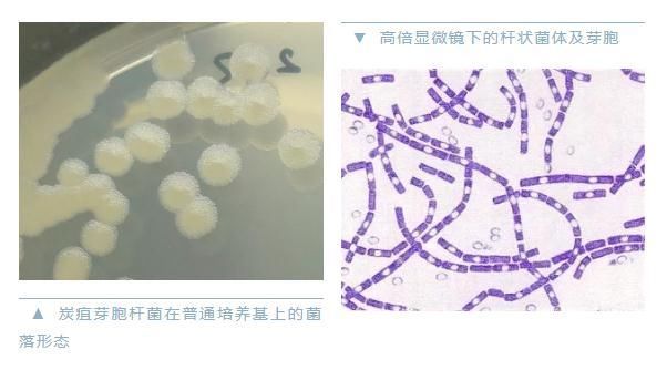 吸入性|警惕炭疽，和新冠同一等级传染病！